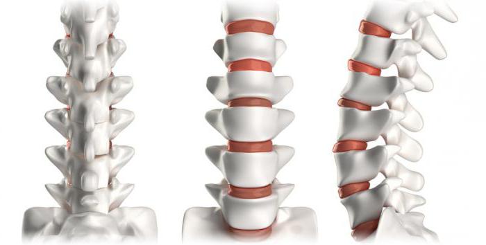 gymnastikk for osteochondrosis cervico thoracic ryggraden vurderinger